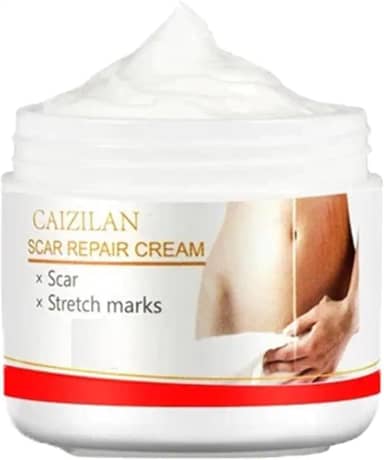 Creme para estrias para mulheres | Adequado para gravidez e pós-parto | Creme anti-estrias | Reparação poderosa para estrias, tratamento para estrias, creme reparador para estrias