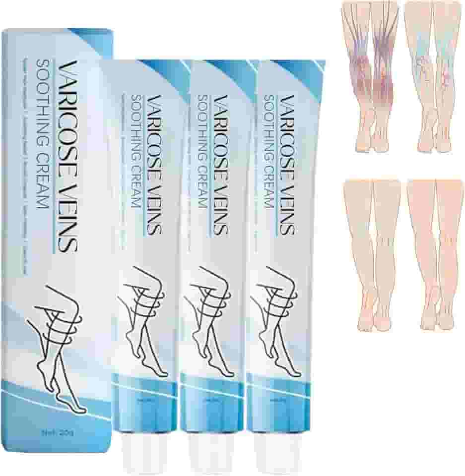 Tratamento Para Varizes Nas Pernas, Creme - Melhora A Circulação Sanguínea, Reduz O Peso (3 Unidades)