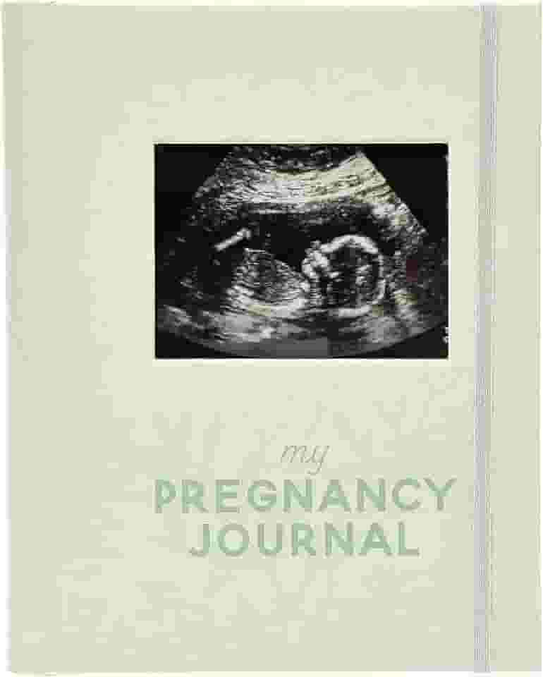 Pearhead My Pregnancy Journal, livro de memórias de gravidez com inserção de foto de ultrassonograma, caderno rastreador de marcos do trimestre de gravidez, presente para mãe grávida, folha verde